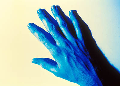 Blue hand   -   Wheaton, IL, 1979   -   Kodak Kodalith & E4 color 35mm slide film